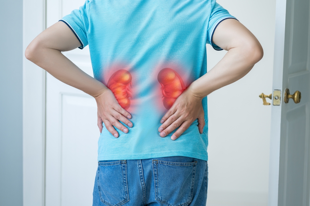 Symptoms of Kidney Stones - Urologist in Guntur
